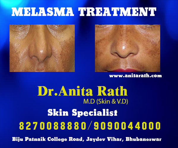 best skin treatment clinic in bhubaneswar, odisha near kar clinic
